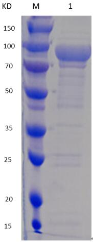 12% SDS-PAGE analysis profiles of purified MCR_RS04560-37-819 (CBB stained).